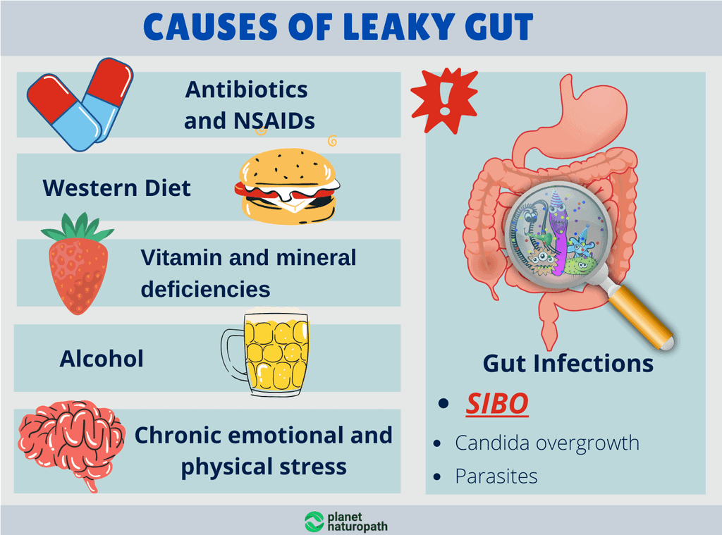 How To Restore Gut Health After Antibiotics
