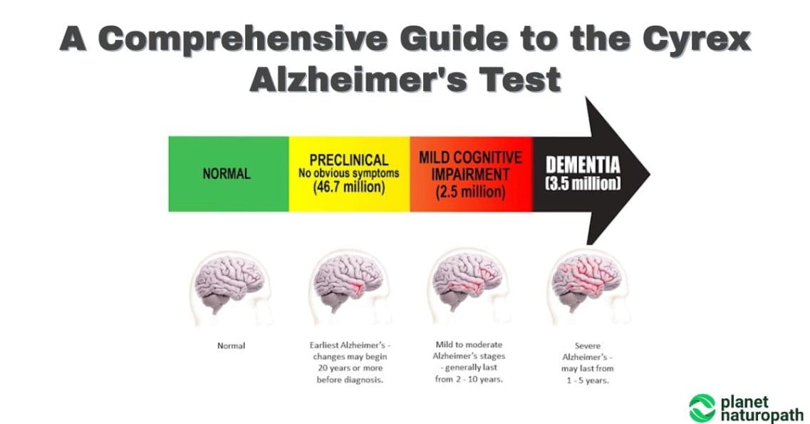A Comprehensive Guide To The Cyrex Alzheimer’s Test