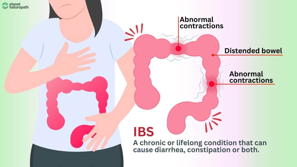 IBS Gut Health