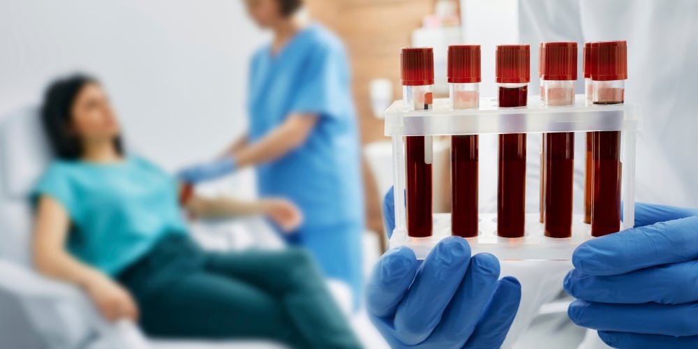 Blood Tests Fatty Liver