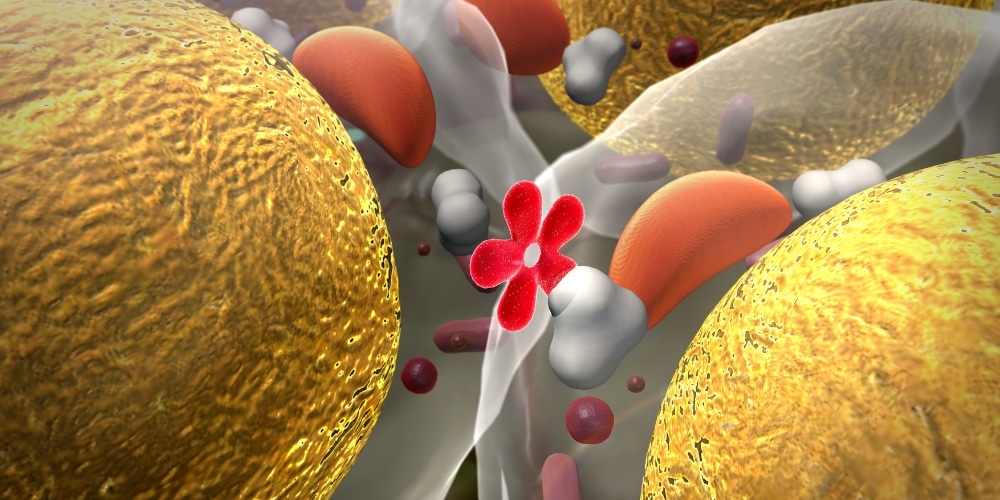 Insulin Resistance