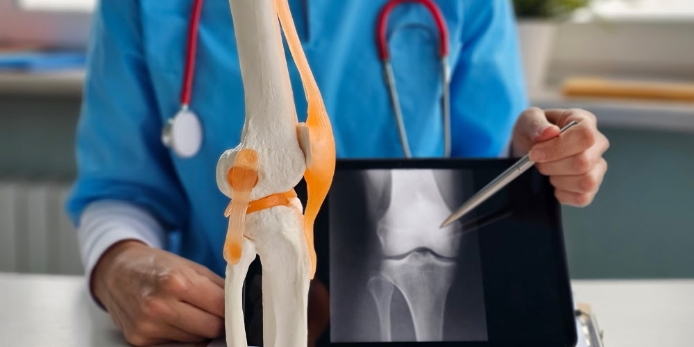 K2 and Bone Health