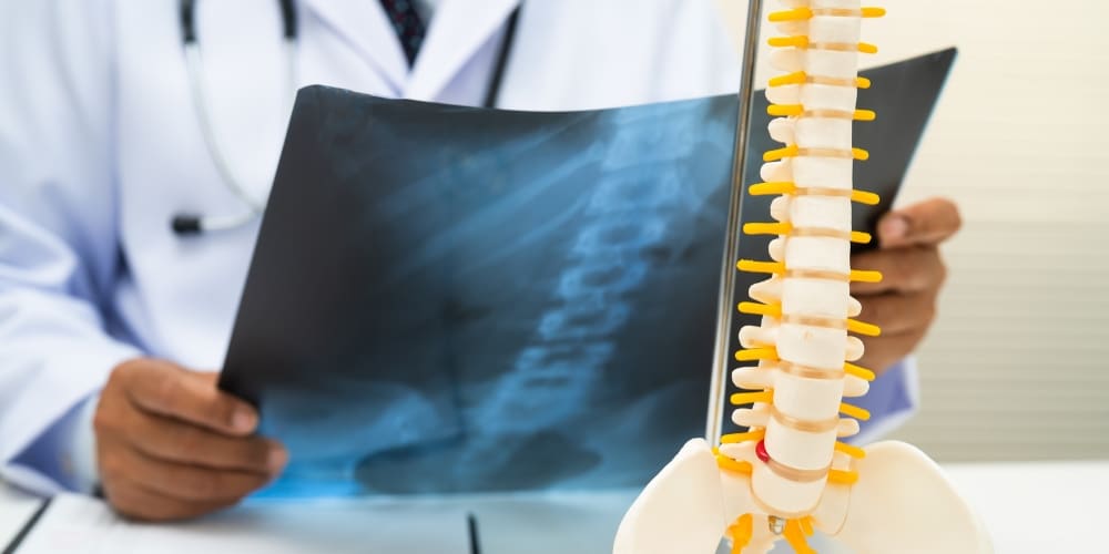 Osteocalcin Bone Anchor