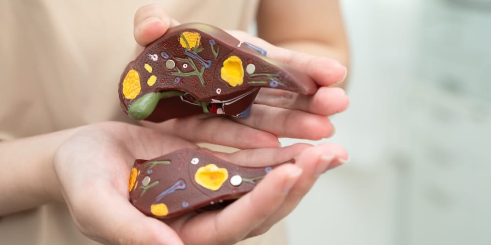 Practical 5-Step Plan For Fatty Liver