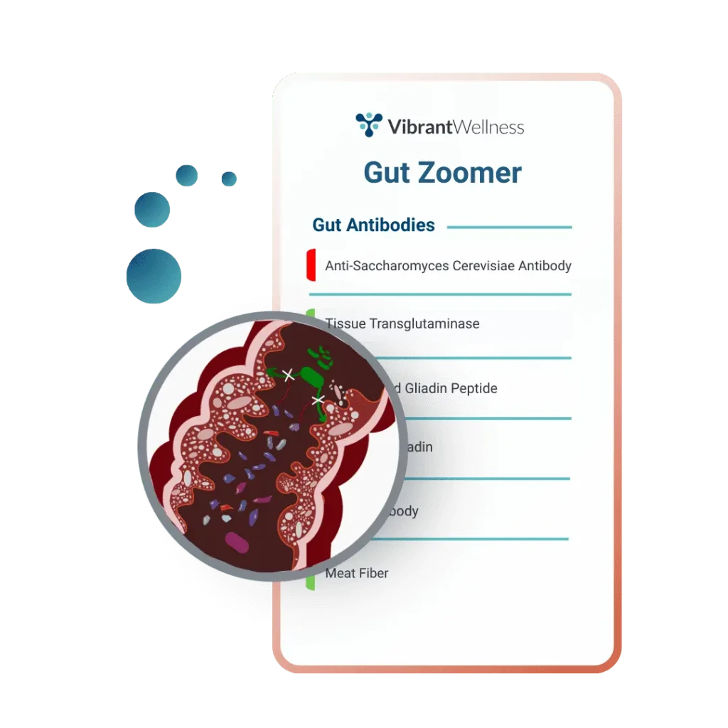 All Tests Available 9 Gut Zoomer test