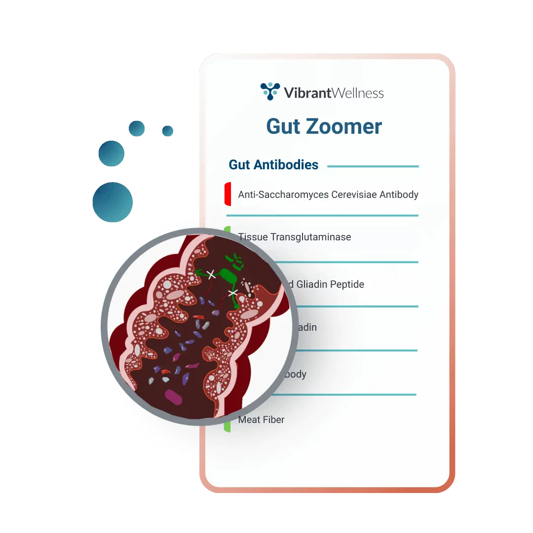 Vibrant Wellness Nutrient Zoomer: Complete Guide 5 Gut Zoomer test